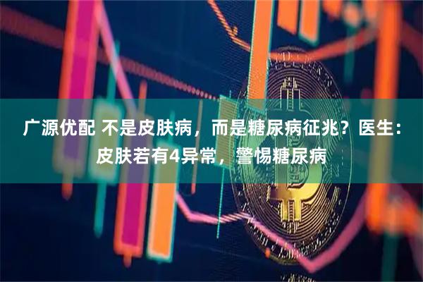 广源优配 不是皮肤病,而是糖尿病征兆?医生:皮肤若有4异常,警惕糖尿病